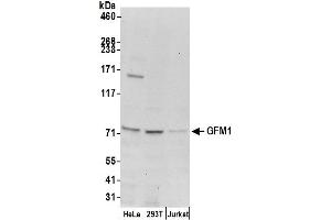 anti-G-Elongation Factor, Mitochondrial 1 (GFM1) (AA 25-75) antibody