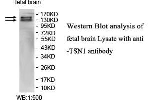 Image no. 1 for anti-Intersectin 1 (ITSN1) antibody (ABIN1577370) (ITSN1 anticorps)