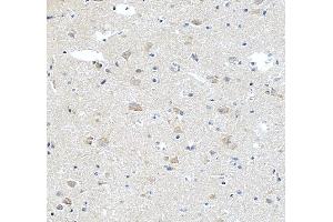IHC analysis of STK24 using anti-STK24 antibody (ABIN7599389).