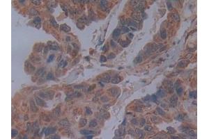 Used in DAB staining on fromalin fixed paraffin- embedded breast cancer tissue (Cadherin 4 anticorps  (AA 667-916))