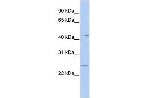 WB Suggested Anti-FAM173B Antibody Titration: 0. (FAM173B anticorps  (N-Term))