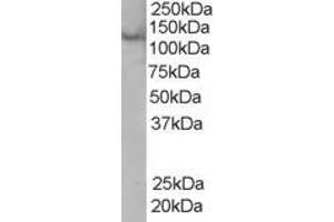 ABIN185061 (0. (Rabenosyn 5 anticorps  (C-Term))