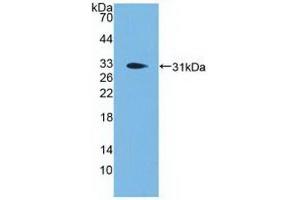 Detection of Recombinant PCSK1, Human using Polyclonal Antibody to Proprotein Convertase Subtilisin/Kexin Type 1 (PCSK1) (PCSK1 anticorps  (AA 500-738))