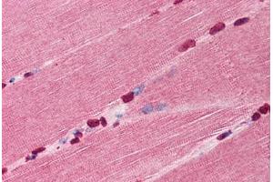 Human Skeletal Muscle (formalin-fixed, paraffin-embedded) stained with TIRAP antibody ABIN297782 at 10 ug/ml followed by biotinylated goat anti-rabbit IgG secondary antibody ABIN481713, alkaline phosphatase-streptavidin and chromogen. (TIRAP anticorps  (N-Term))