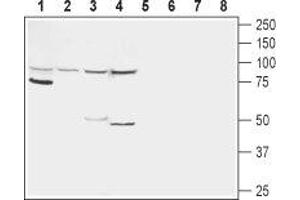 Western blot analysis of rat kidney (lanes 1 and 5), rat liver (lanes 2 and 6), mouse liver (lanes 3 and 7) and human HepG2 liver carcinoma cell line (lanes 4 and 8) lysates:  - 1-4. (Glucagon Receptor anticorps  (1st Extracellular Loop))