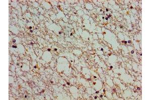 Immunohistochemistry of paraffin-embedded human brain tissue using ABIN7146404 at dilution of 1:100