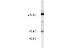 dilution: 1 : 1000, sample: rat hippocampus lysate (CACNA1B anticorps  (AA 1921-2222))