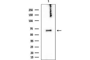 Western blot analysis of lysates from COLO205 cells, using NF2 / Merlin Mouse Monoclonal Antibody at 1/1000 dilution.