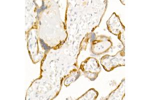 Immunohistochemistry of paraffin-embedded human placenta using Cytokeratin 19 (KRT19) Rabbit pAb (ABIN3020778, ABIN3020779, ABIN3020780 and ABIN6213719) at dilution of 1:50 (40x lens).