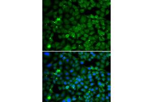 Immunofluorescence analysis of MCF-7 cells using SMYD4 antibody. (SMYD4 anticorps  (AA 1-260))
