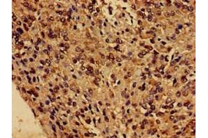 anti-FUN14 Domain Containing 1 (FUNDC1) (AA 1-46) antibody