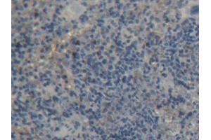 IHC-P analysis of Rat Spleen Tissue, with DAB staining. (PTPRA anticorps  (AA 618-796))