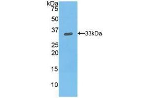 Detection of Recombinant ITGb1, Mouse using Polyclonal Antibody to Integrin Beta 1 (ITGb1)