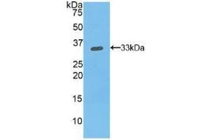 Detection of Recombinant ITGb1, Mouse using Polyclonal Antibody to Integrin Beta 1 (ITGb1) (ITGB1 anticorps  (AA 454-714))