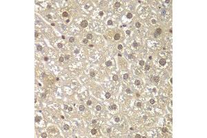 Immunohistochemistry of paraffin-embedded mouse liver using MAD1L1 antibody. (MAD1L1 anticorps  (AA 360-700))