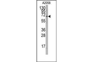 Image no. 1 for anti-RAR-Related Orphan Receptor A (RORA) antibody (ABIN356632) (RORA anticorps)