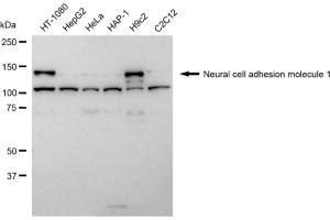 Western blotting analysis using Neural cell adhesion molecule 1 antibody (ABIN7799572).