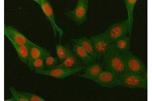 IF analysis of NR3C2 using anti-NR3C2 antibody (ABIN3043575) and anti-Tubulin Alpha antibody (ABIN7600339).