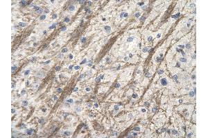 Rabbit Anti-ZNF74 antibody        Paraffin Embedded Tissue:  Human Brain cell   Cellular Data:  Epithelial cells of renal tubule  Antibody Concentration:   4. (ZNF74 anticorps  (Middle Region))