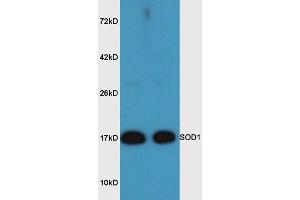 Mouse brain lysates probed with Rabbit Anti-SOD1 Polyclonal Antibody, Unconjugated  at 1:3000 for 90 min at 37˚C. (SOD1 anticorps  (AA 6-100))