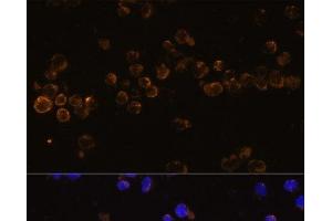 Immunofluorescence analysis of Jurkat cells using KLRC4 Polyclonal Antibody at dilution of 1:100 (40x lens). (KLRC4 anticorps)