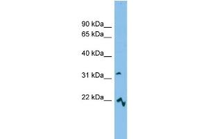WB Suggested Anti-MCART6 Antibody Titration: 0. (MCART6 anticorps  (Middle Region))