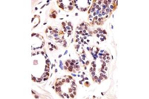 Immunohistochemical analysis of paraffin-embedded H. (T-Box 1 anticorps  (C-Term))