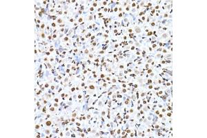 Immunohistochemistry of paraffin-embedded rat ovary using RBM3 Rabbit mAb (ABIN7270084) at dilution of 1:25 (40x lens). (RBM3 anticorps)