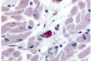 Immunohistochemistry (Formalin/PFA-fixed paraffin-embedded sections) of human macrophages tissue with EMR3 polyclonal antibody . (EMR3 anticorps  (N-Term))