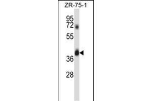 DGT1 Antibody (N-term) (ABIN657891 and ABIN2846843) western blot analysis in ZR-75-1 cell line lysates (35 μg/lane). (DPAGT1 anticorps  (N-Term))