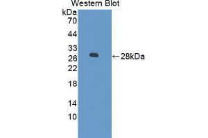 Western blot analysis of the recombinant protein.