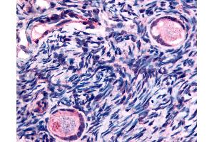 Anti-TMEM5 antibody IHC of human ovary, oocytes. (TMEM5 anticorps  (Extracellular Domain))