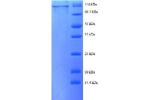 SDS-PAGE (SDS) image for Catenin (Cadherin-Associated Protein), beta 1, 88kDa (CTNNB1) (AA 2-781), (partial) protein (GST tag) (ABIN5712039) (CTNNB1 Protein (AA 2-781, partial) (GST tag))
