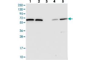 Western blot analysis of Lane 1: RT-4, Lane 2: U-251 MG, Lane 3: Human Plasma, Lane 4: Liver, Lane 5: Tonsil with POLR3E polyclonal antibody  at 1:250-1:500 dilution. (POLR3E anticorps)