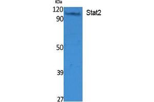 Western Blotting (WB) image for anti-Signal Transducer and Activator of Transcription 2, 113kDa (STAT2) (Tyr1221), (Tyr1222) antibody (ABIN6284459)