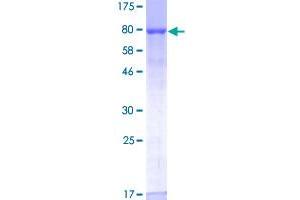 NEDD8 Activating Enzyme E1 Subunit 1 (NAE1) (AA 1-534) protein (GST tag)