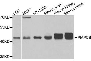 Western blot analysis of extracts of various cells, using PMPCB antibody. (PMPCB anticorps)
