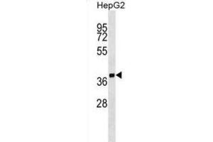 Western Blotting (WB) image for anti-Secretory Carrier Membrane Protein 2 (SCAMP2) antibody (ABIN2999377) (SCAMP2 anticorps)