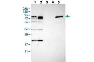 Western blot analysis of Lane 1: RT-4, Lane 2: U-251 MG, Lane 3: Human Plasma, Lane 4: Liver, Lane 5: Tonsil with PNPLA8 polyclonal antibody  at 1:250-1:500 dilution. (PNPLA8 anticorps)