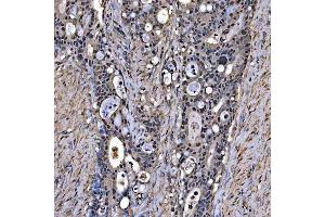 IHC analysis of SNRPA1 using anti-SNRPA1 antibody (ABIN7599131).