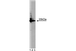 Western Blotting (WB) image for anti-HCLS1 Associated Protein X-1 (HAX1) (AA 10-148) antibody (ABIN968199)
