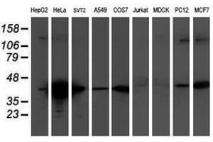 Image no. 2 for anti-Tropomodulin 1 (TMOD1) antibody (ABIN1501528) (Tropomodulin 1 anticorps)