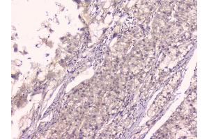IHC analysis of TNFRSF11B using anti-TNFRSF11B antibody (ABIN7600875).