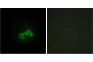 Immunofluorescence (IF) image for anti-Bladder Cancer Associated Protein (BLCAP) (AA 38-87) antibody (ABIN2889532) (BLCAP anticorps  (AA 38-87))
