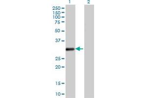 Western Blot analysis of VDAC2 expression in transfected 293T cell line by VDAC2 monoclonal antibody (M01), clone 3D2.