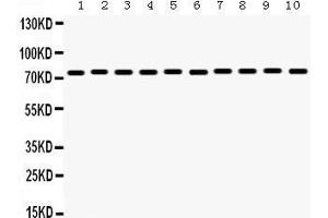 Western Blotting (WB) image for anti-Heat Shock 70kDa Protein 9 (Mortalin) (HSPA9) (AA 646-679), (C-Term) antibody (ABIN3043853)