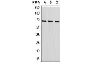 Western blot analysis of HIC2 expression in HepG2 (A), HeLa (B), NIH3T3 (C) whole cell lysates. (HIC2 anticorps  (Center))