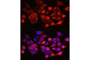 Immunofluorescence analysis of HeLa cells using Cytokeratin 17 (KRT17) Rabbit pAb (ABIN6130112, ABIN6143023, ABIN6143024 and ABIN6213626) at dilution of 1:200 (40x lens). (KRT17 anticorps  (AA 133-432))