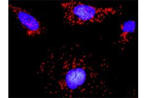 Proximity Ligation Analysis of protein-protein interactions between CDC42 and ARHGEF6. (ARHGEF6 anticorps  (AA 61-175))