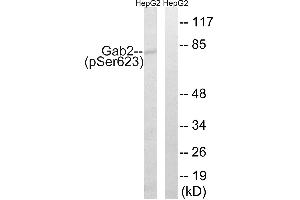 Immunohistochemistry analysis of paraffin-embedded human breast carcinoma tissue using Gab2 (Phospho-Ser623) antibody. (GAB2 anticorps  (pSer623))
